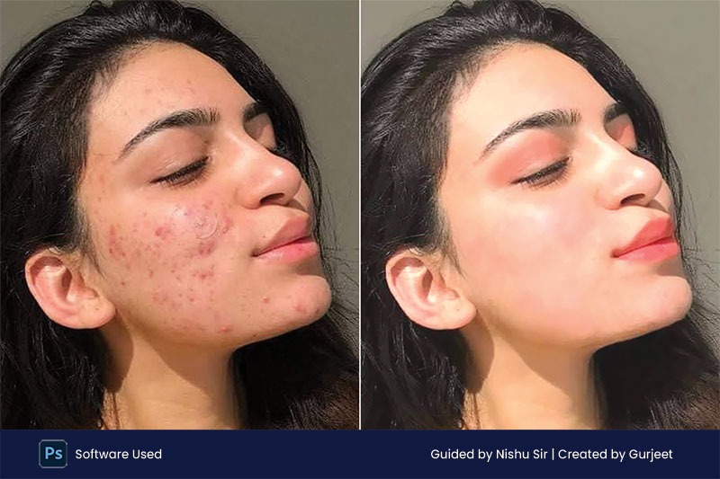 Skin Photo Retouching in Adobe Photoshop